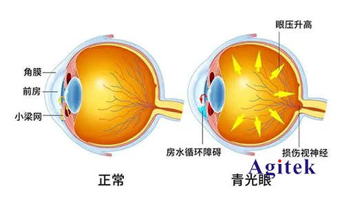 TH2851系列高精密阻抗分析儀在新型眼科中的應(yīng)用(圖1)